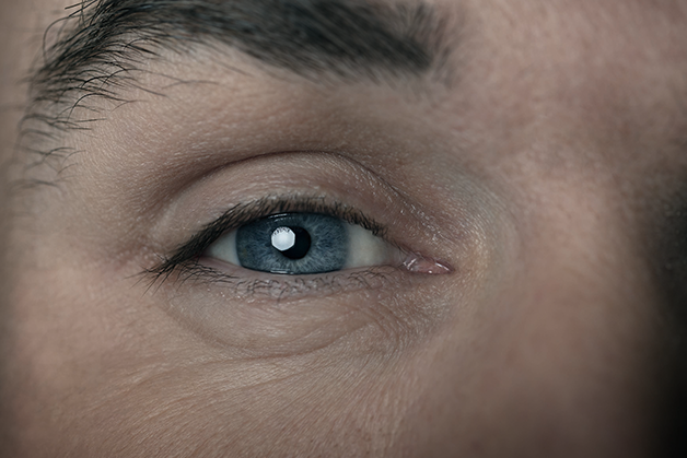 All-encompassing support